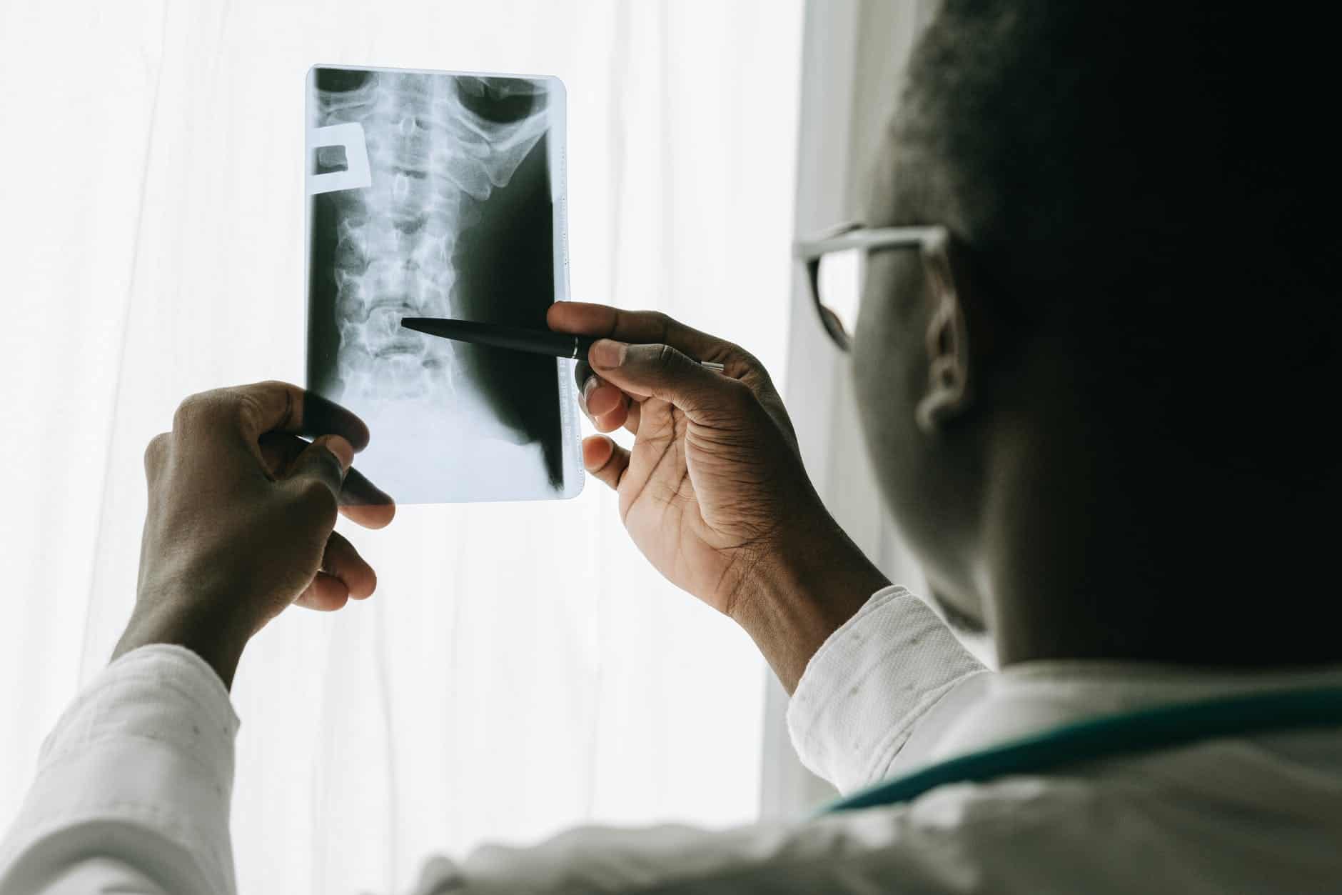 doctor examining an x-ray image